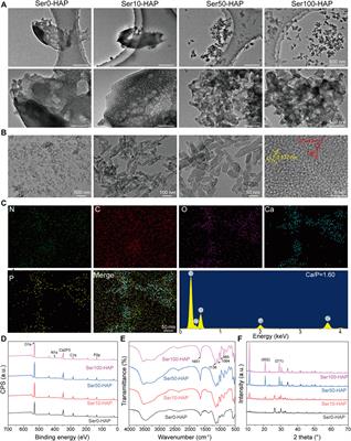 Biomimetic Design and Fabrication of Sericin-Hydroxyapatite Based Membranes With Osteogenic Activity for Periodontal Tissue Regeneration